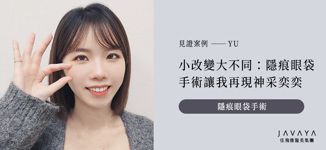 小改變大不同,隱痕眼袋手術讓我再現神采奕奕